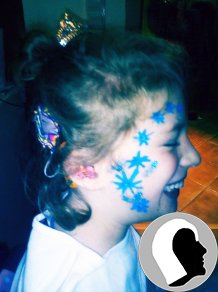 CI Kopf 2018 weiblich Kind